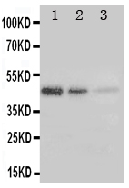 1 - Anti-ERBB3/Her3 Antibody ABO11187