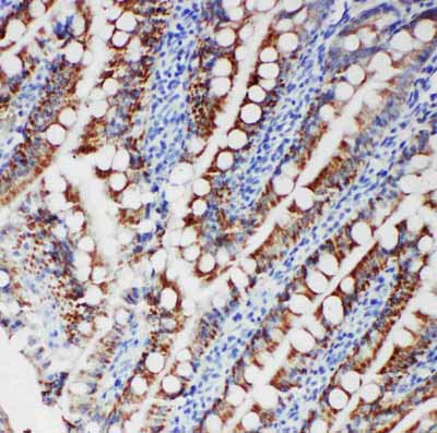 2 - Anti-FER Antibody ABO11189