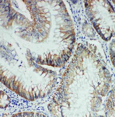 2 - Anti-FER Antibody ABO11189