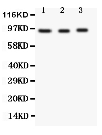 1 - Anti-FER Antibody ABO11189
