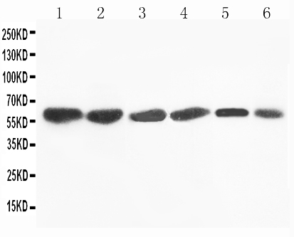 1 - Anti-Flavin Containing Monooxygenase 4 Antibody ABO11190