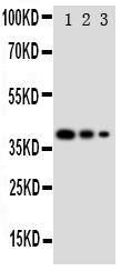 1 - Anti-GATA2 Antibody ABO11191