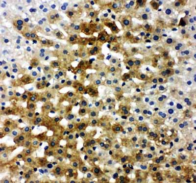 2 - Anti-Bone SialoProtein Antibody ABO11193
