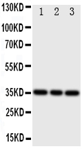 1 - Anti-Bone SialoProtein Antibody ABO11193