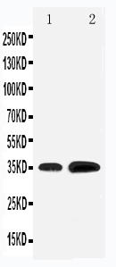 1 - Anti-KLF3 Antibody ABO11194