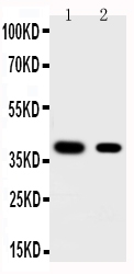 1 - Anti-KLF5 Antibody ABO11195