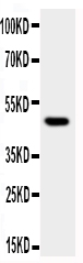 1 - Anti-JNK1 Antibody ABO11197
