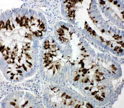 2 - Anti-p107 Antibody ABO11198