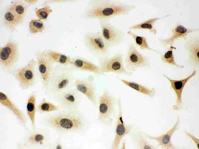 8 - Anti-SHC Antibody ABO11201