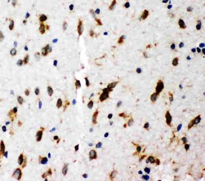 2 - Anti-SHC Antibody ABO11201