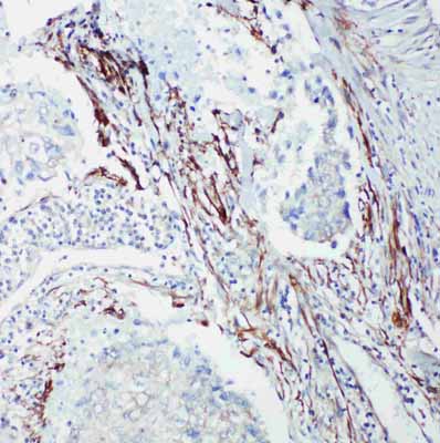 2 - Anti-SHC Antibody ABO11201