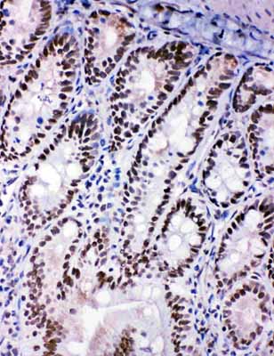 2 - Anti-SHC Antibody ABO11201