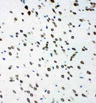 2 - Anti-SHC Antibody ABO11201