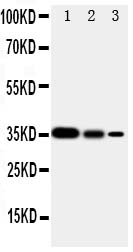 1 - Anti-SHC Antibody ABO11201