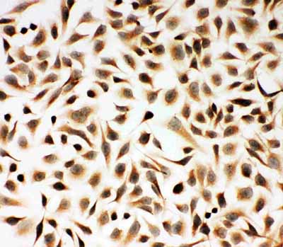 8 - Anti-Smad2 Antibody ABO11202