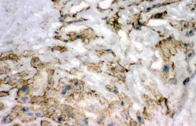 2 - Anti-SOD3 Antibody ABO11203