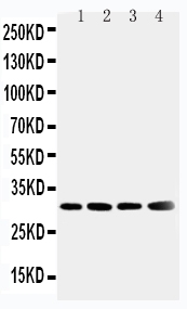 1 - Anti-SOD3 Antibody ABO11203