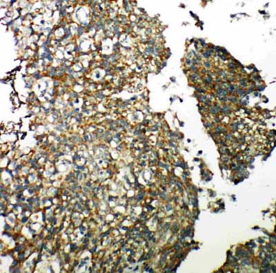 2 - Anti-TXNRD2 Antibody ABO11207
