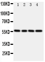 1 - Anti-TXNRD2 Antibody ABO11207
