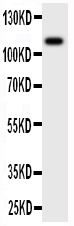 1 - Anti-CSF1R/M-CSFR Antibody ABO11209