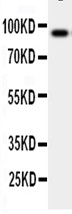 1 - Anti-CSF3R/G-CSF R Antibody ABO11210