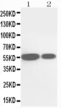 1 - Anti-CYP2E1 Antibody ABO11213