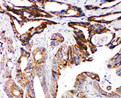 2 - Anti-DCC Antibody ABO11214
