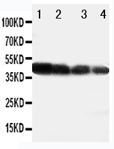 1 - Anti-DLL3 Antibody ABO11216