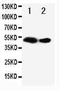 1 - Anti-Flt-3ligand Antibody ABO11217