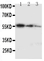 1 - Anti-Ki67 Antibody ABO11221