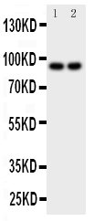 1 - Anti-MALT1 Antibody ABO11223