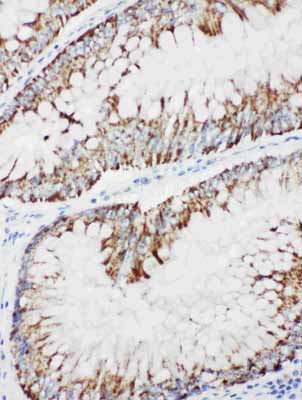 2 - Anti-MEKK1 Antibody ABO11226