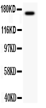 1 - Anti-MEKK1 Antibody ABO11226
