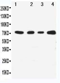 1 - Anti-MEKK3 Antibody ABO11227