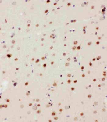 2 - Anti-MEKK3 Antibody ABO11228