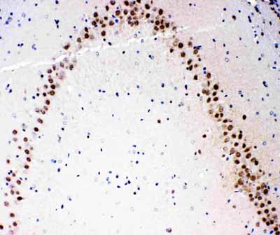 2 - Anti-MEKK3 Antibody ABO11228