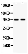 1 - Anti-MEKK3 Antibody ABO11228