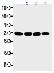 1 - Anti-Matrilin 3 Antibody ABO11230