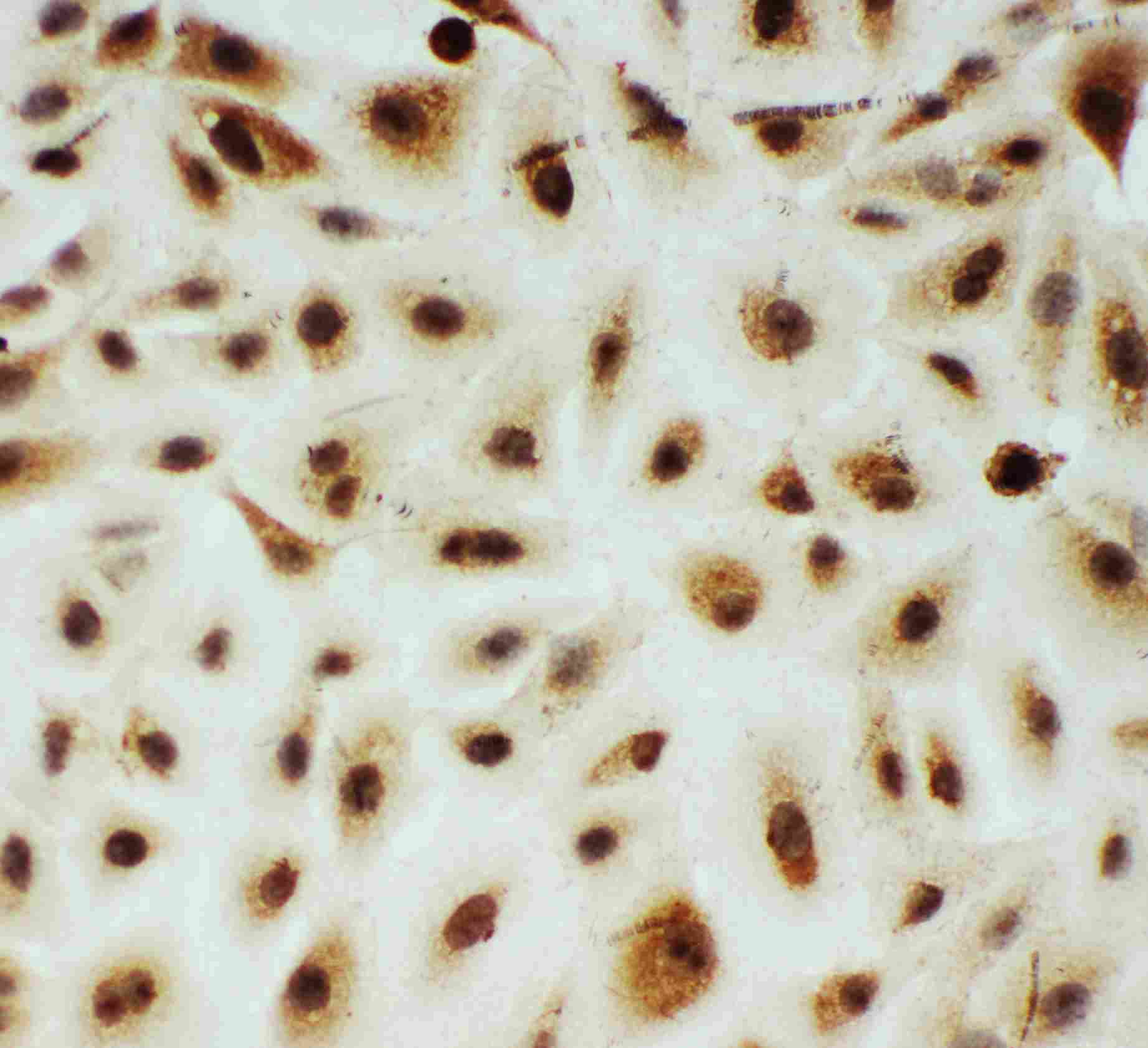 8 - Anti-B MyB Antibody ABO11231
