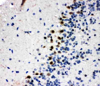 2 - Anti-B MyB Antibody ABO11231