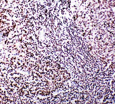 2 - Anti-B MyB Antibody ABO11231