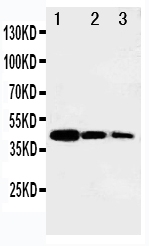 1 - Anti-B MyB Antibody ABO11231