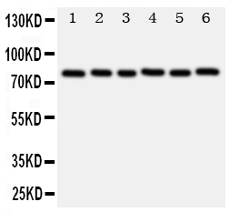 1 - Anti-B MyB Antibody ABO11231