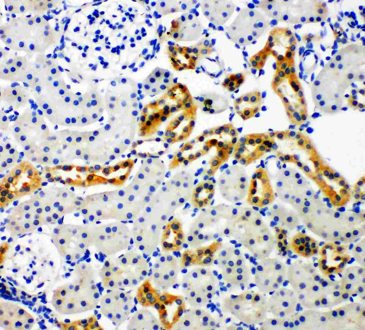 2 - Anti-NADPH Oxidase 4 Antibody ABO11232