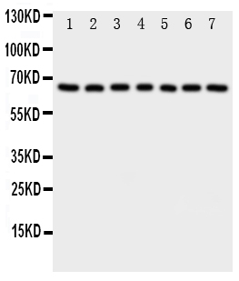 1 - Anti-NADPH Oxidase 4 Antibody ABO11232