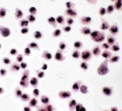 8 - Anti-Nucleophosmin Antibody ABO11234