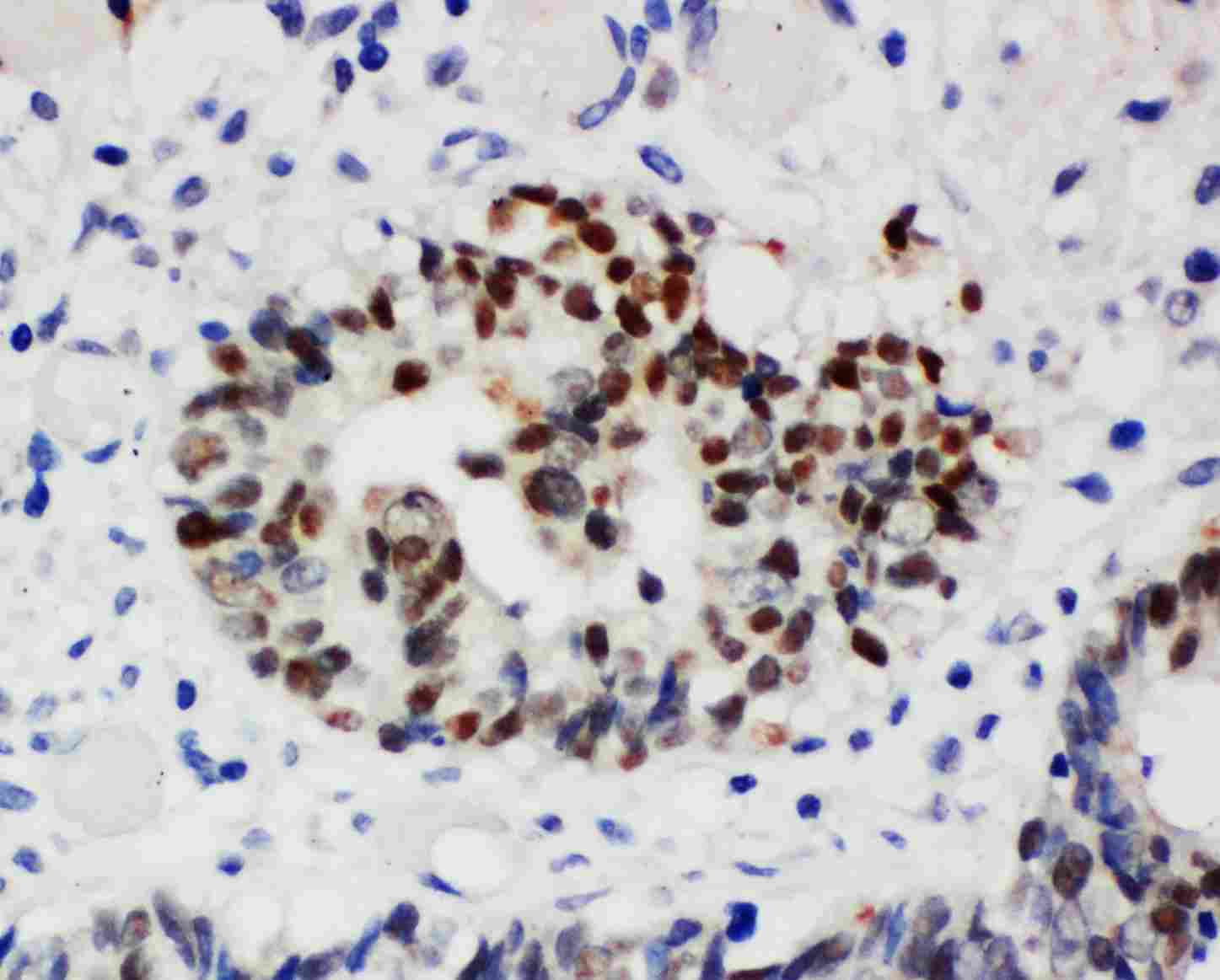 2 - Anti-Nucleophosmin Antibody ABO11234