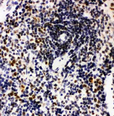 2 - Anti-Nucleophosmin Antibody ABO11234