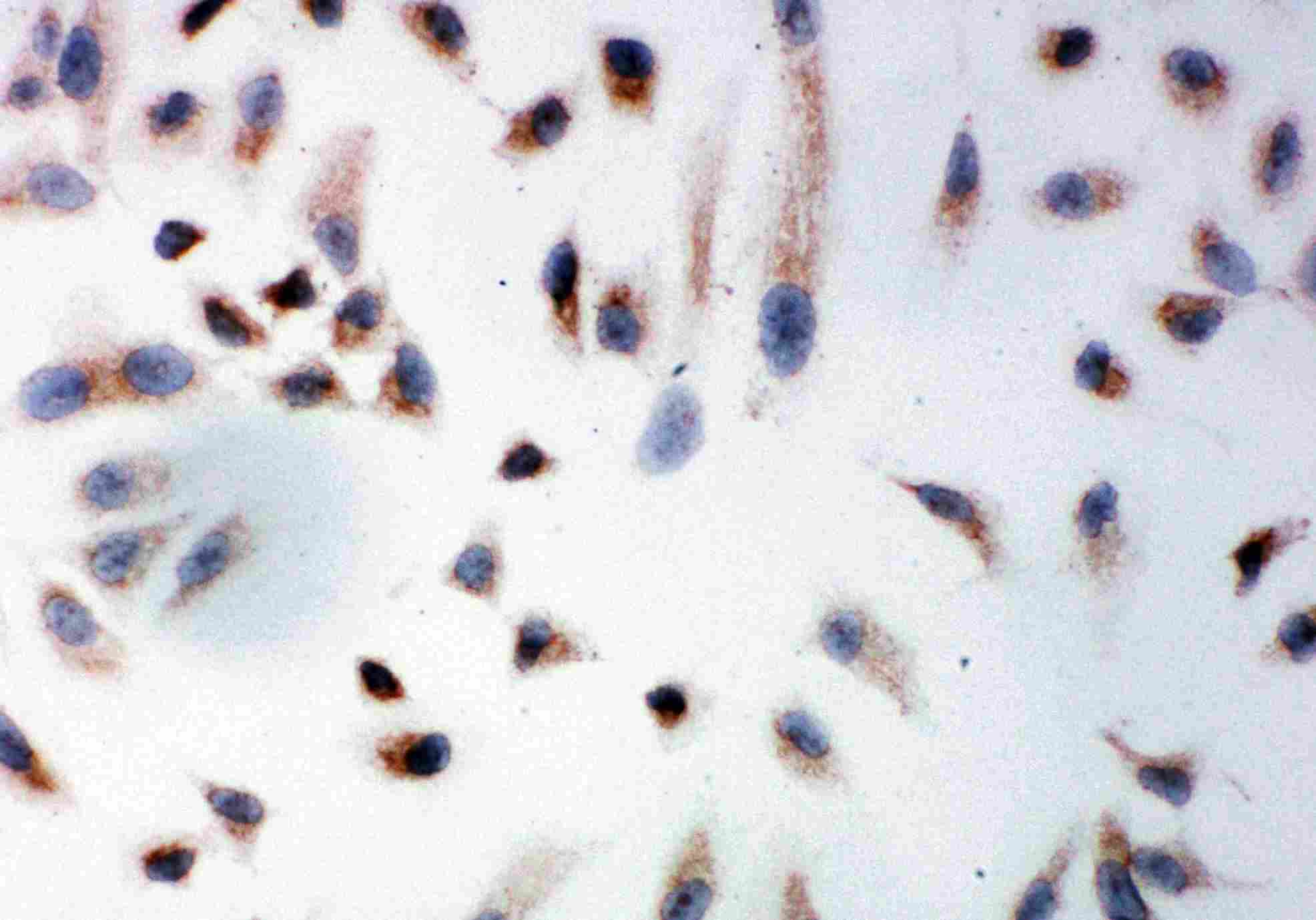 8 - Anti-Prohibitin Antibody ABO11235