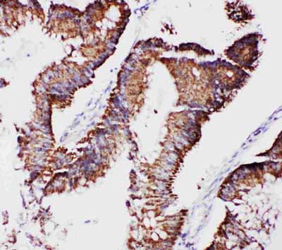 2 - Anti-mtTFA Antibody ABO11239